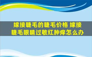 嫁接睫毛的睫毛价格 嫁接睫毛眼睛过敏红肿痒怎么办